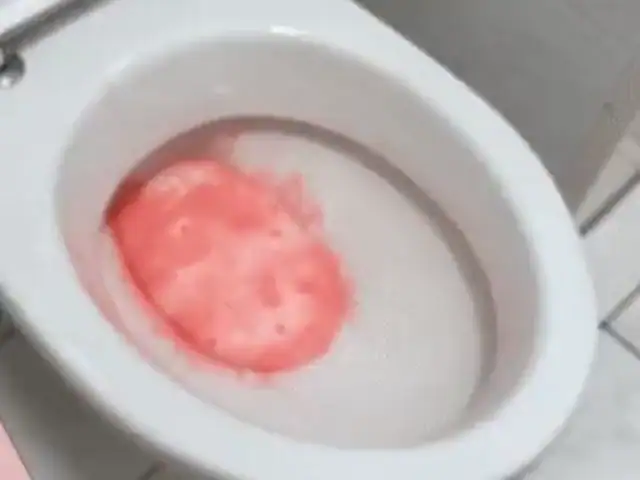 Der WC-Schaum dehnt sich in der Toilettenschüssel aus